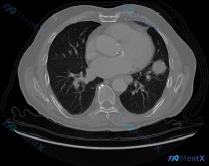 Post 333 image 1
