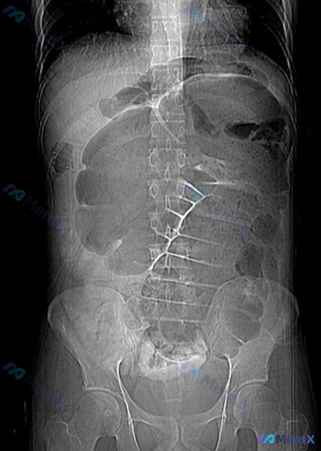 Post Image 1