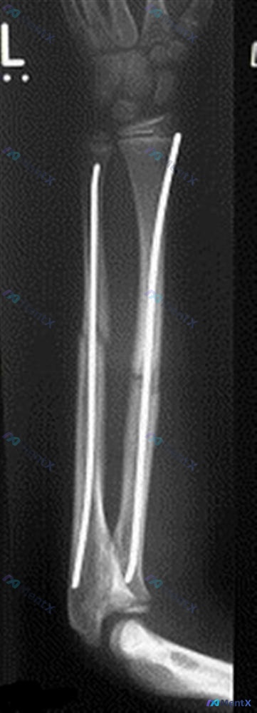 Post 2330 image 2