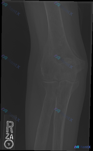 Post 4390 image 1