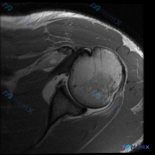 Post 28164 image 1