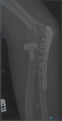 Post Image 1
