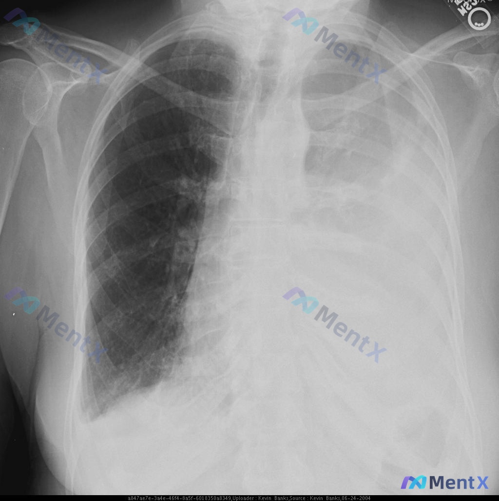 Post 2695 image 1