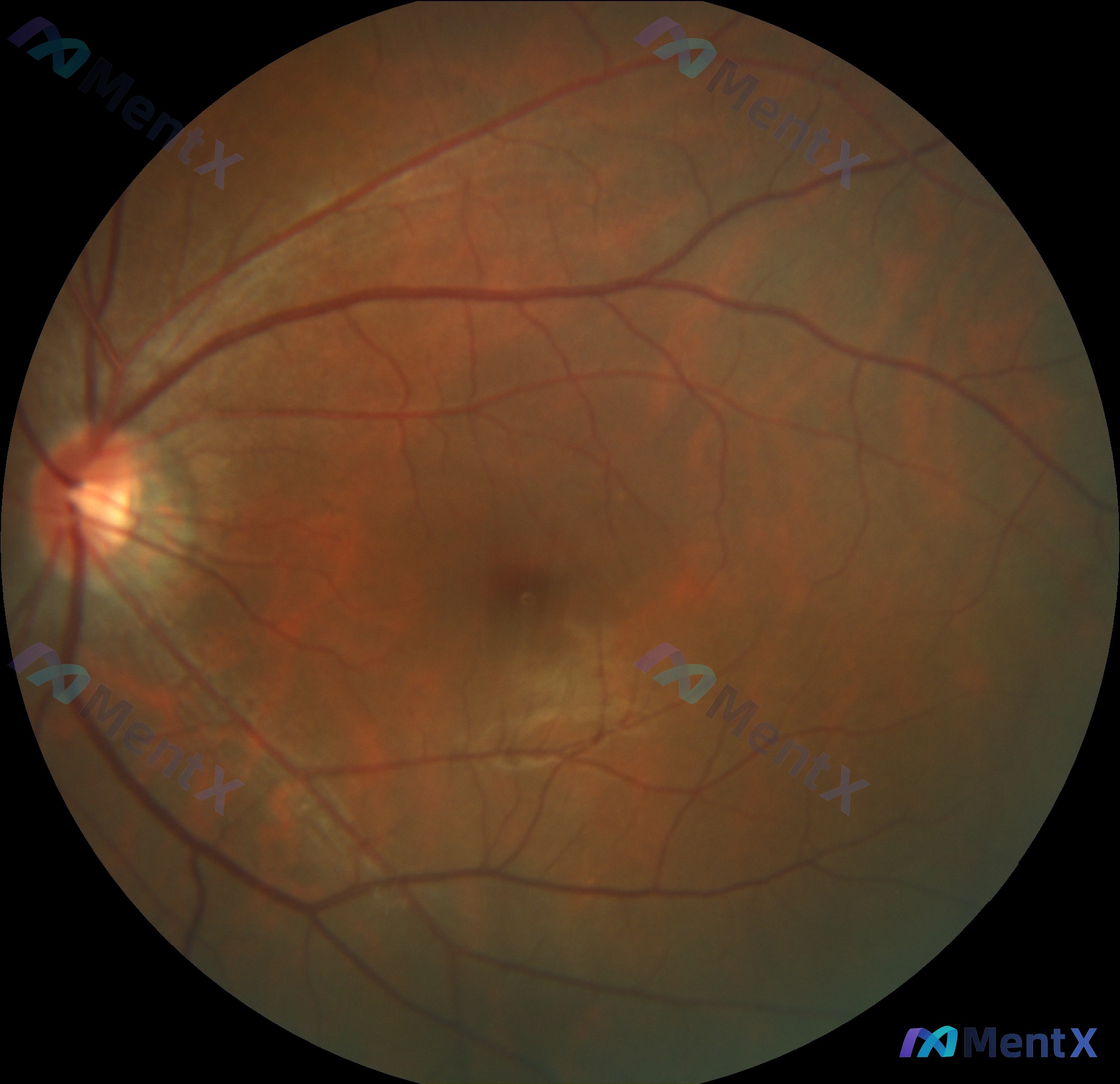 Post 2993 image 1
