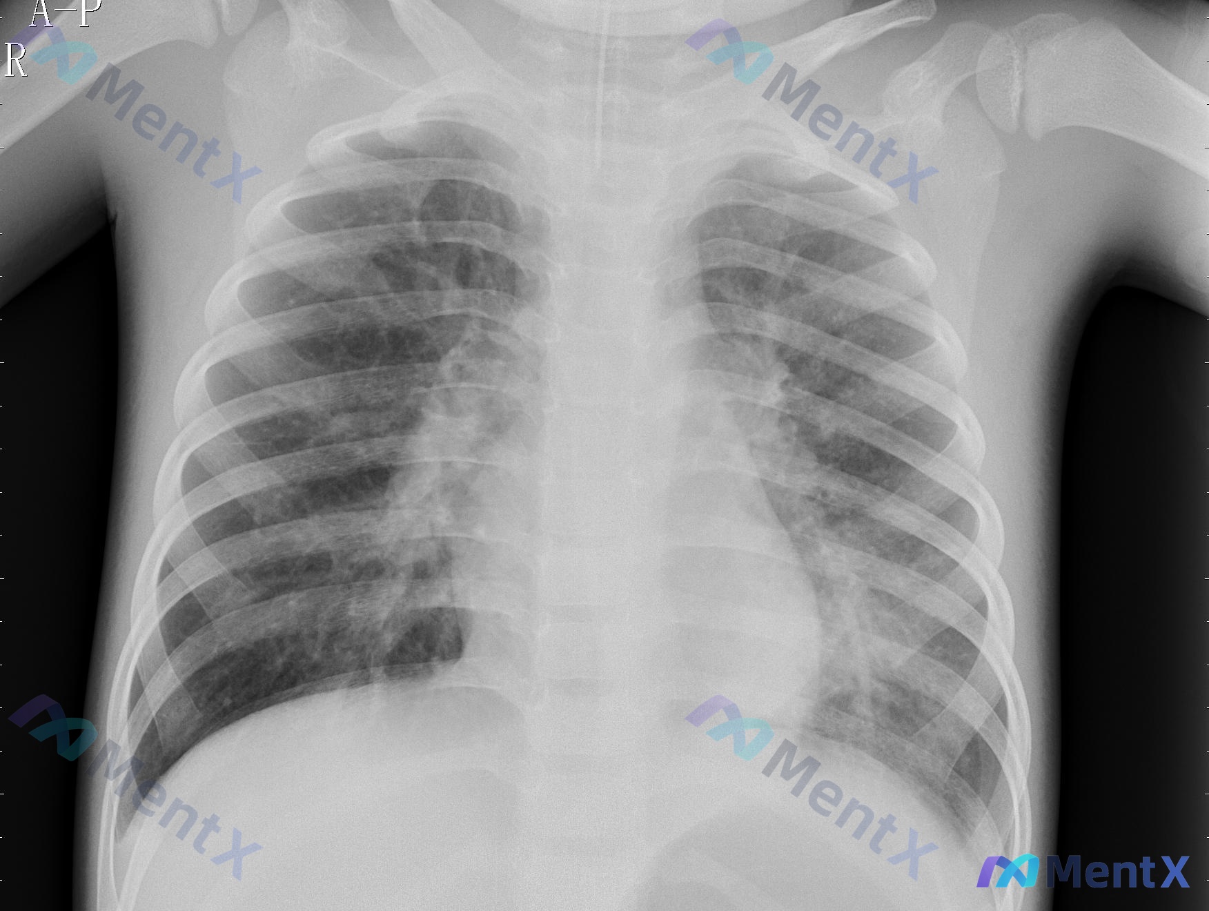 Post 2878 image 1