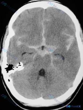 Post 2706 image 1