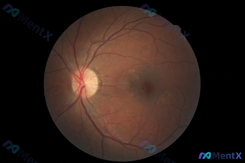 Post 2031 image 1