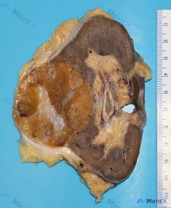Post 42 image 2