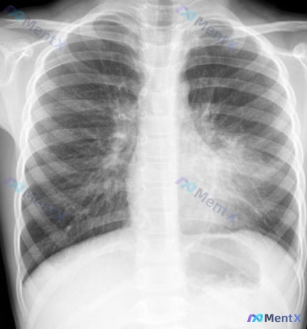 Post 875 image 1