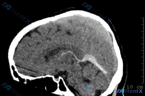 Post 1230 image 1