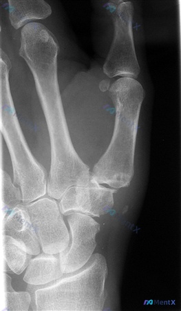 Post 421 image 1