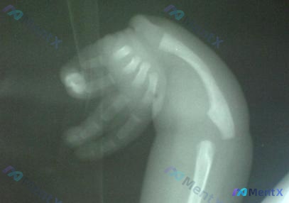 Post 1987 image 3