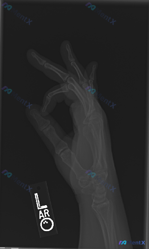 Post Image 1