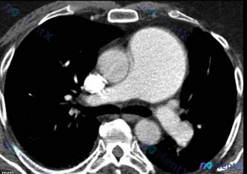 Post 1310 image 3