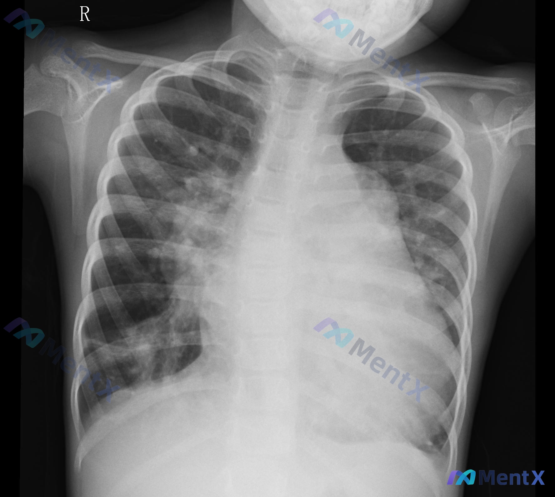 Post 1145 image 1