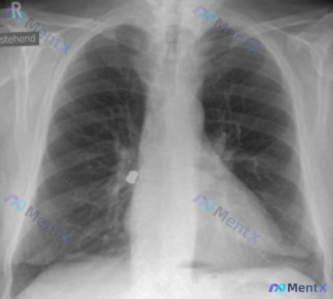 Post 1512 image 1