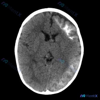 Post 336 image 1