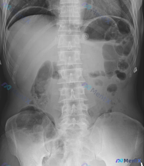 Post 2318 image 1