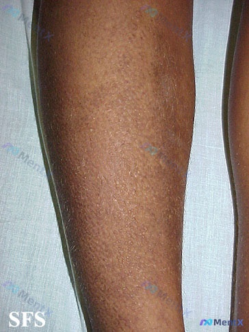 Post 3550 image 1
