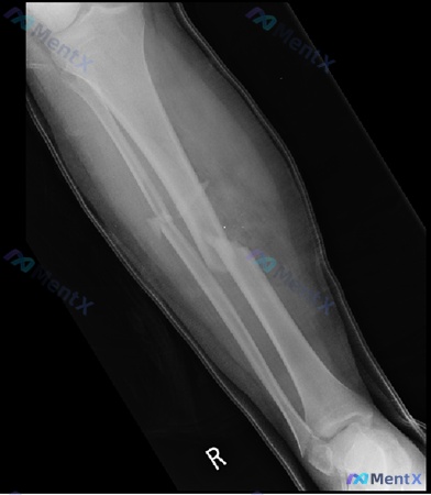 Post 54 image 2