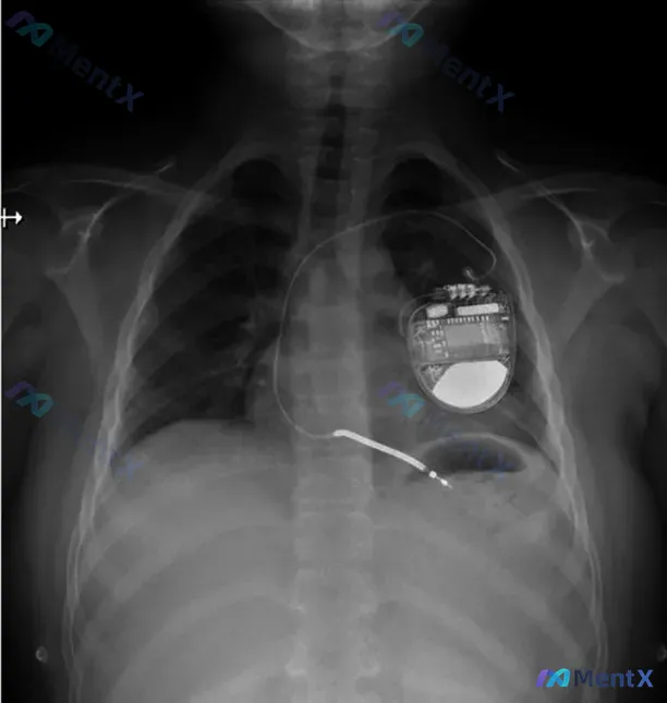 Post 5693 image 1