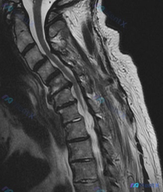Post 2311 image 1