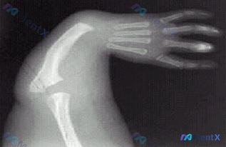 Post 1750 image 2