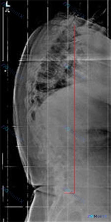 Post 1252 image 2