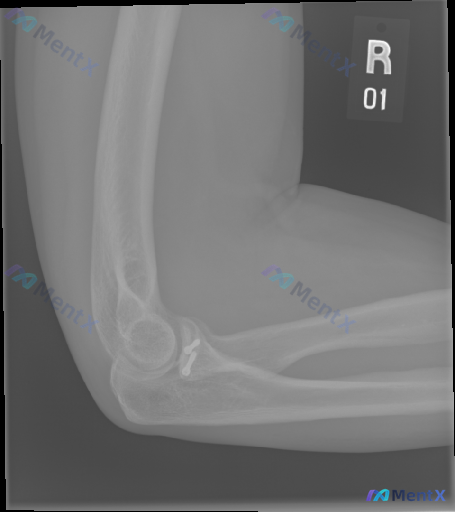 Post 3210 image 1