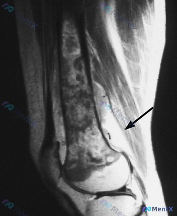 Post 2060 image 3