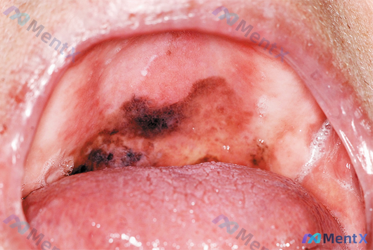 Post 2110 image 1