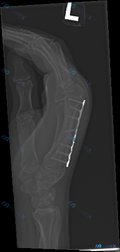 Post Image 1