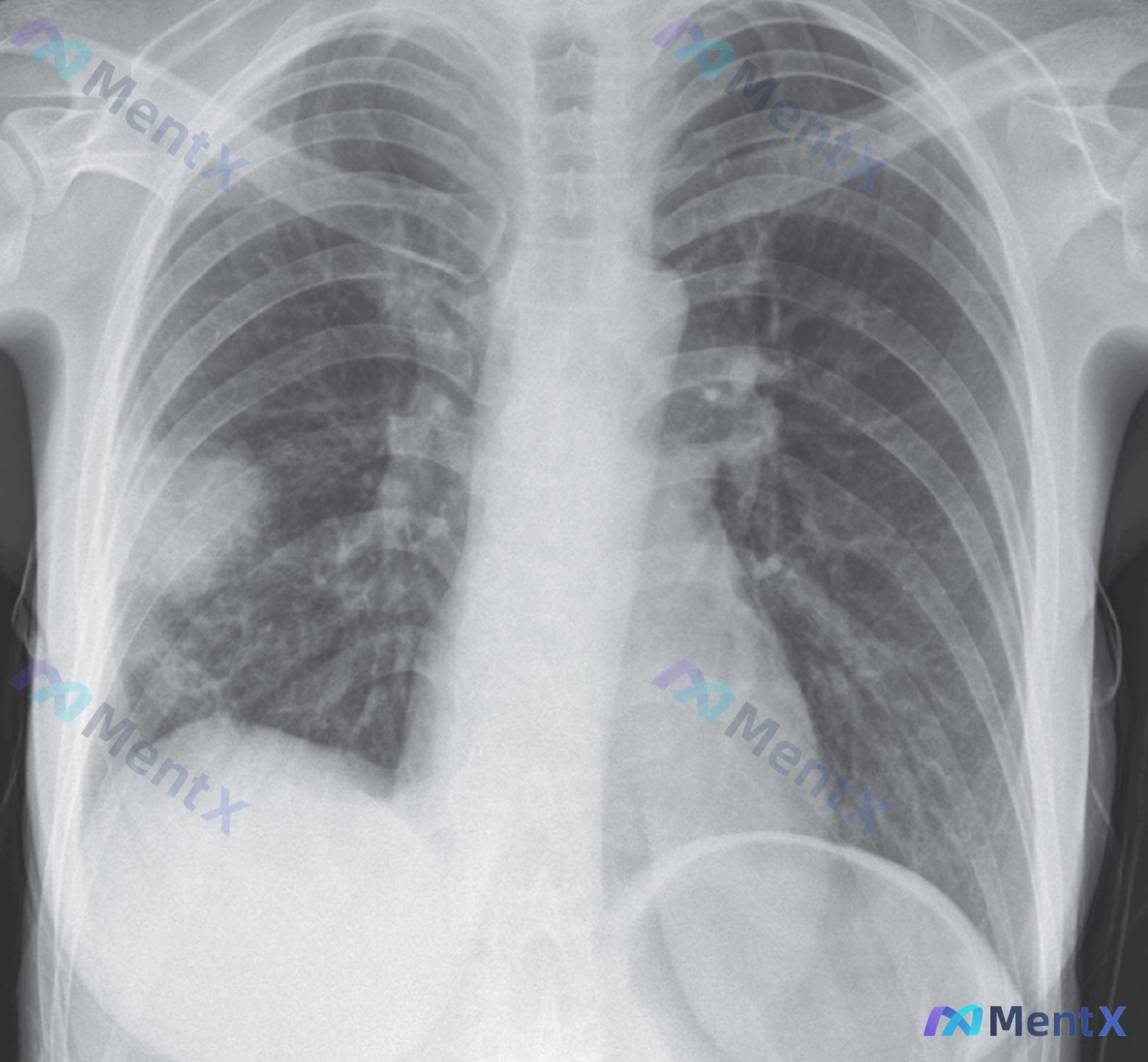 Post 351 image 1