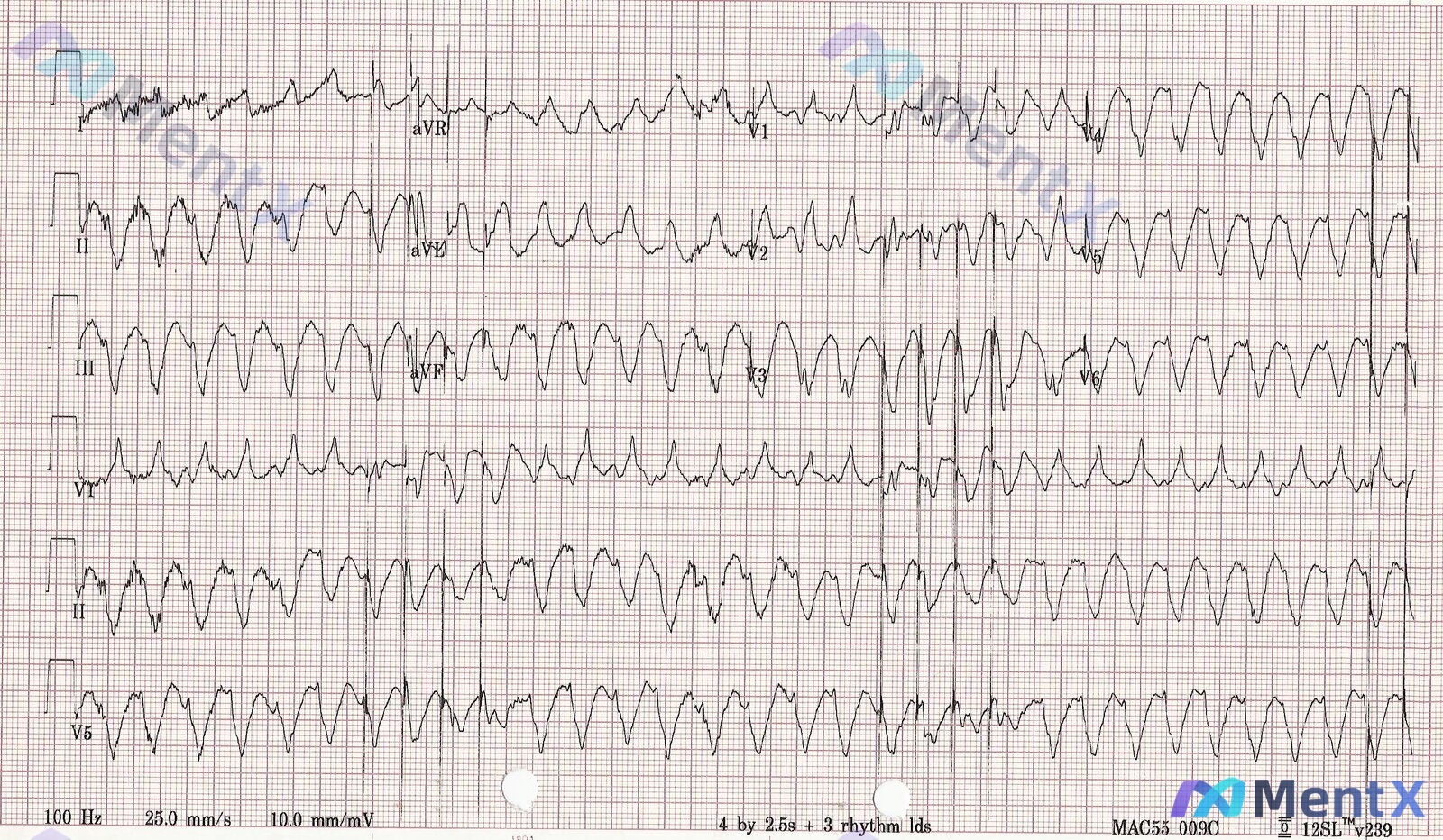 Post 211 image 1