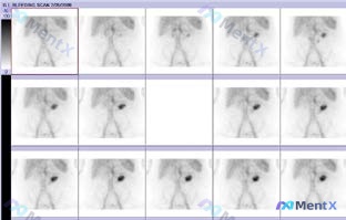 Post 1398 image 1