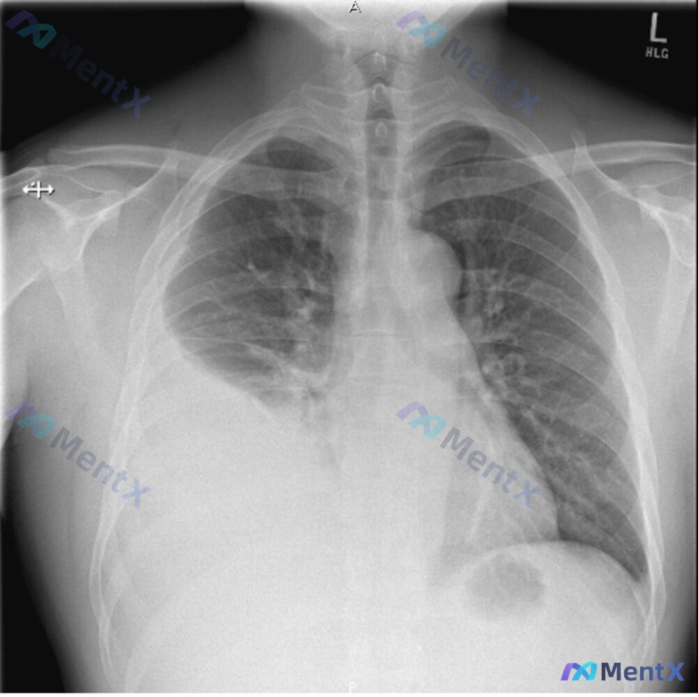 Post 2187 image 1
