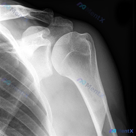 Post 1110 image 2