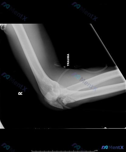 Post 1648 image 1