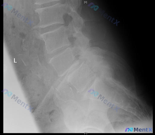 Post 320 image 1