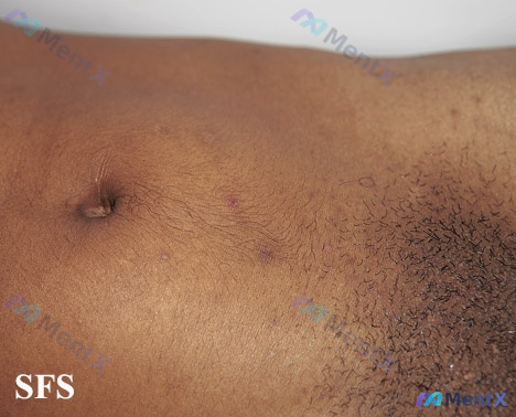 Post 4662 image 1