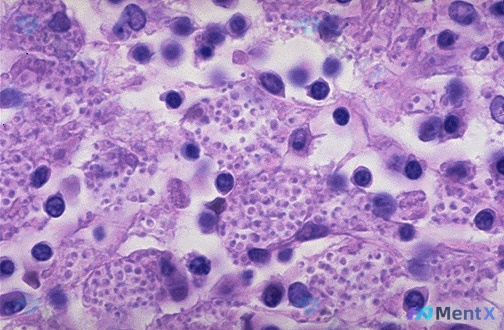 Post Image 5