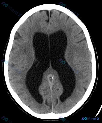 Post 590 image 1