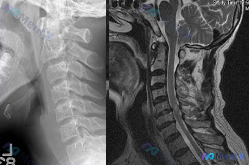 Post Image 5