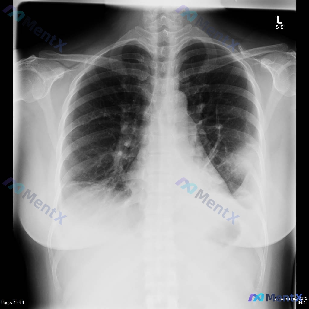 Post 240 image 1