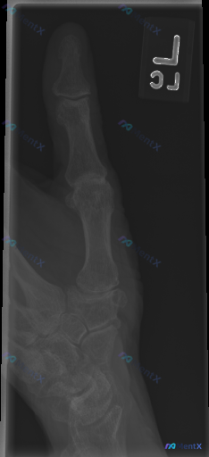 Post 3856 image 1