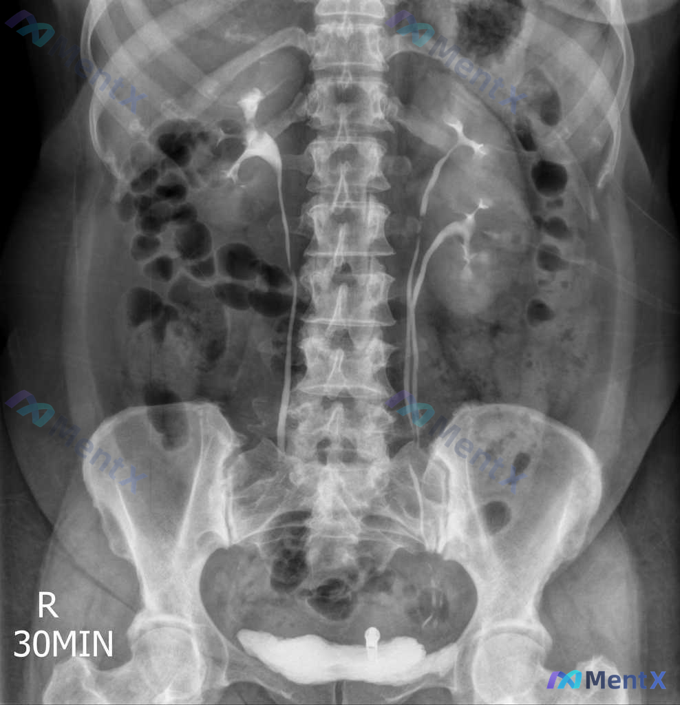 Post 1510 image 1