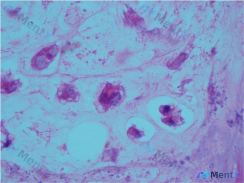 Post Image 5
