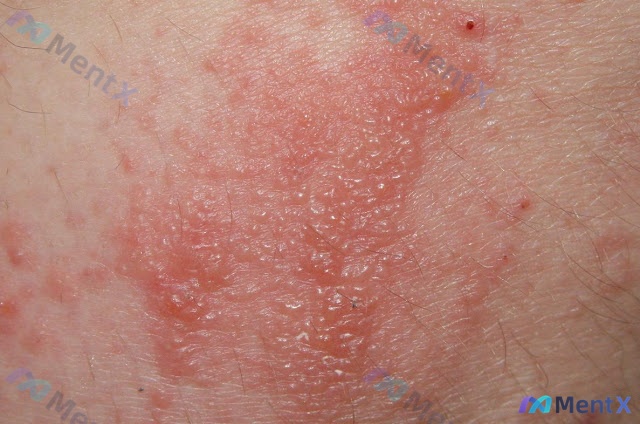Post 45 image 1