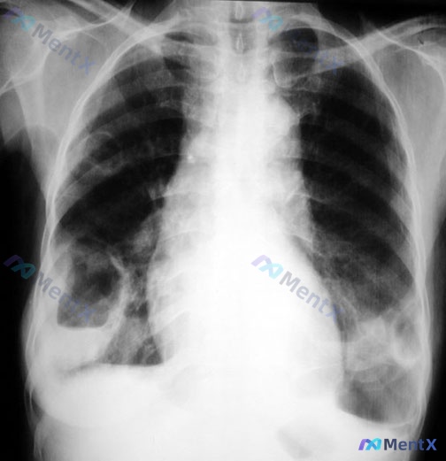 Post 2862 image 1