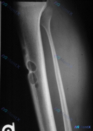 Post 2103 image 1